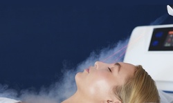 One or Two Cryo Facials at Absolute Zero Cryo (Up to 53% Off)