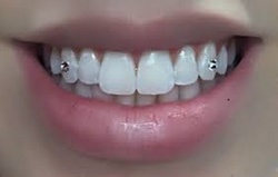 Up to 51% Off on Teeth Whitening - In-Office - Non-Branded at Lashez & Smilez by Bre