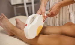 Six Laser Hair-Removal Treatments at Revital Laser and Skin Clinic (Up to 82% Off). Two Options Available.