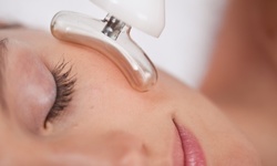 Diamond Microdermabrasion with LED Light Therapy from Evelyn at The Getaway Spa and Salon (Up to 61% Off)
