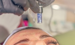 One, Two, or Three Microneedling Facial Treatments at The Rock Spa (Up to 66% Off)