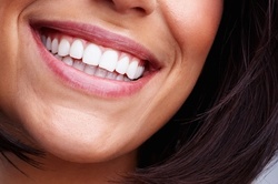 Up to 68% Off on Teeth Whitening - Home Tray / Pen at onlymissses