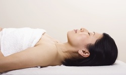One Dermaplaning Session with Optional Mini Facial at Vitalize Medical Spa (Up to 60% Off)