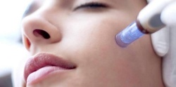 Up to 64% Off on Micro-Needling at Aesthetics On Highland