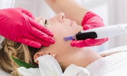 One or Two Microneedling Facials at Imaginique Med Spa (Up to 73% Off)