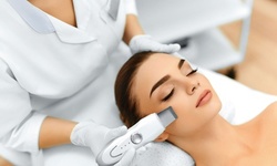 One or Three Microdermabrasions at Elite Pro Wellness Health & Beauty Center (Up to 61% Off)