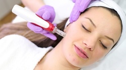 Up to 56% Off on Facial - Peeling at Beauty & Brows Bar LLC