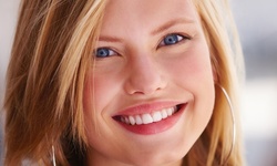 20 or 40 Units of Xeomin at Juvia Med Spa (Up to 52% Off) 