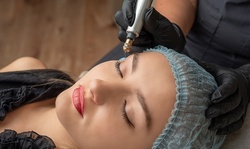 Up to 32% Off on Facelift - Non-Surgical at Angels' Lounge Beauty Spa
