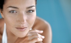 15- or 30-Minute Radio Frequency Facial at BodyLift Houston (Up to 44% Off)