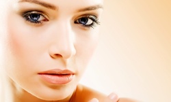 One or Two VI Peels at Midtown Beauty (Up to 72% Off)