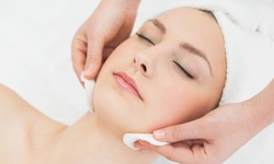 $90.40 for One Microneedling Treatment at Elliot M. Hirsch, MD ($375 Value)