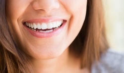 Dental Exam, X-Ray, and Basic Cleaning for One or Two at Ancestry Dental (Up to 61% Off)