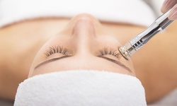 Crystal Microdermabrasion with LED or Deep-Pore Facials at Bella’s Med Spa (Up to 51% Off). 4 Options Available.