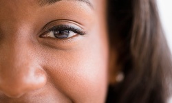 $159.20 for One PRF Natural Eye Filler at JLJ MedSpa ($245 Value)