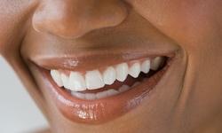 Dental Exam, Cleaning, and X-Rays for One or Two People or a Kid at Custom Dental (Up to 75% Off)