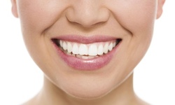 Up to 66% Off Teeth Whitening  at The Pearl Bar