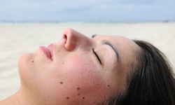 One, Two, or Three Skin Tag Removal Treatments at The Blessings Medical Clinic (Up to 44% Off)