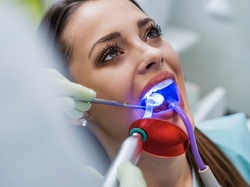 Laser Teeth Whitening with Enamel Protector, Desensitizer, and Optional Take-Home Kit at Flossy  (Up to 72% Off)