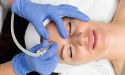Hydrodermabrasion, Microdermabrasion, or Pore Cleansing Facials at Blue Skin Laser Spa (Up to 62% Off)