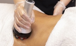 Up to 48% Off on Cavitation at Building barbies body sculpting