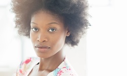 VI Chemical Peel with Optional Booster or One Skin Medica Peel Facial at Revive Med Spa (Up to 51% Off)