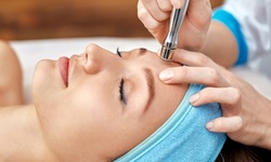 One or Three Ultrasonic Facials with Diamond Microdermabrasion Treatments at Butterfly Skin Care (Up to 75% Off)