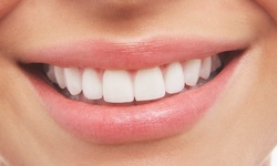 Consultation, Exam, Cleaning, and X-rays at Smile More Dentistry (Up to 83% Off)