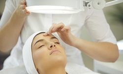 Up to 76% Off on Micro-Needling at New Image Aesthetics