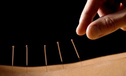Up to 71% Off on Acupuncture at Abril Acupuncture Wellness