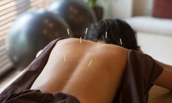 One or Two Acupuncture Sessions with Cupping Therapy at DJ Beauty (Up to 60% Off)