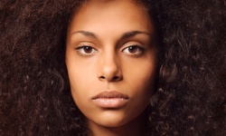 One Syringe of Juvéderm Ultra at New You Medspa at New You Medspa (Up to 40% Off). Two Options Available.