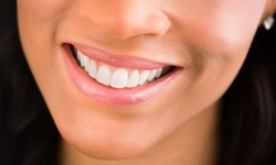 Up to 80% Off on Dental Checkup at Lorraine N. Hindy DMD PA