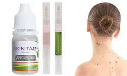 Wart Remover Pen Skin Tag Remover Medical Wart Treatment for Skin Care
