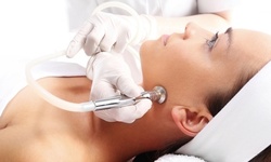 One Diamond Microdermabrasion with Eye and Lip Treatment or Light Peel at Rival Aesthetics (Up to 55% Off)