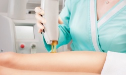 Two, Four, or Six Ultrasonic Fat- and Cellulite-Reduction Treatments at West Lake Body Sculpting (Up to 93% Off)