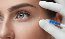 $133.89 for 50 Units of Dysport Injections at PurAesthetics Rejuvenation & Wellness ($175 Value)