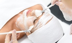 One or Five Microdermabrasion Facials at U2 Beauty Spa (Up to 44% Off)