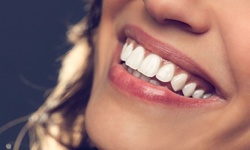 $200 Off Byte Aligners + BrightByte Pro w/ Byteme Discount Code
