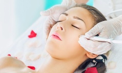 One or Two PRP Facial Treatments at Advanced Medical Institute (Up to 75% Off)