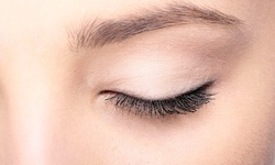 Blepharoplasty on the Upper or Lower Eyelids, or Both Upper and Lower Eyelids at Doheny Sunset Surgery Center (Up to 40% Off) 