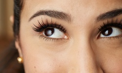 $1,129 for Eyelid Lift at Noel S. Tenenbaum, MD Plastic & Reconstructive Surgery ($4,500 Value)