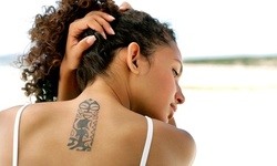 PicoSure Tattoo Removal for a Small, Medium, or Large Area from Kerin MedSpa & Laser Center (Up to 68% Off)