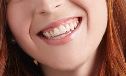 One Dental Exam and X-ray with Optional Basic Cleaning at The Dental Studio (86% Off)