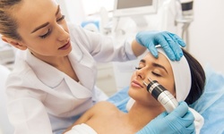 One, Two, or Four Therma-Lift Skin-Tightening Facelifts at West Lake Body Sculpting (Up to 90% Off)