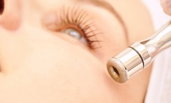 Up to 46% Off on Microdermabrasion at Essential Day Spa And Cosmetics Inc