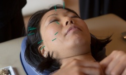 Acupuncture, Massage, or Annual Membership Fee at Wellness Herbal Essence (Up to 71% Off). 5 Options Available.