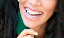 Dental Cleaning, X-rays, Exam and Take-Home Whitening Kit at Robert G Marx DDS & Associates (Up to 88% Off) 