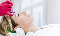 One or Two PRP and Microneedling Treatments at Skin Code LA (Up to 71% Off)