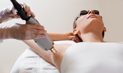 Six Laser Hair-Removal Sessions on One Small, Medium, or Large Area at Skin Code LA (Up to 73% Off)